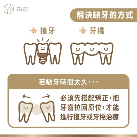 缺牙會漏財嗎|缺牙一定要補嗎？醫:當心造成7大後遺症，固定牙橋、活動假牙、。